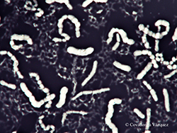 Tinción negativa. Bacillus megaterium