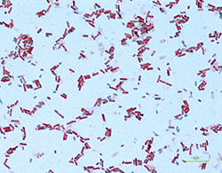 Bacillus polymyxa. Tinción de esporas.
