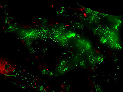Bacterias en flóculos (EDAR). Viabilidad celular.